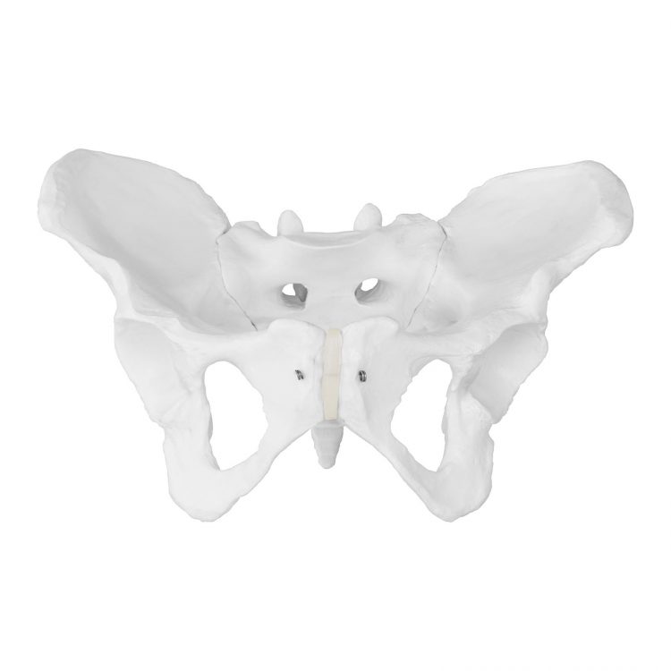 Model kostry ženskej panvy - 1