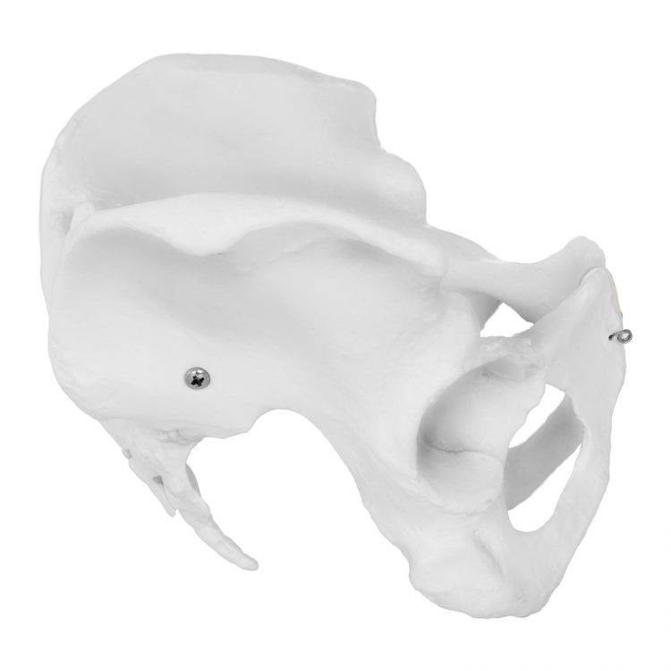 Model kostry ženskej panvy - 2